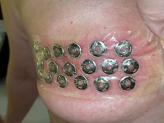 Frigidity eliminación de chinches de las tetas