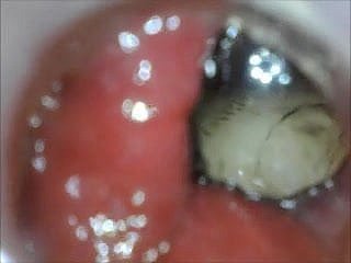 Juego de culo de endoscopio anal desde adentro