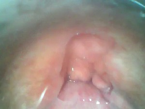 Видео Scope до моей FAT Свиней пизды. Внутри Sinistral